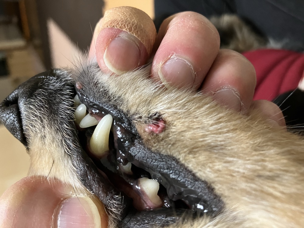 唇にできた皮脂腺腫。手術前の記録写真